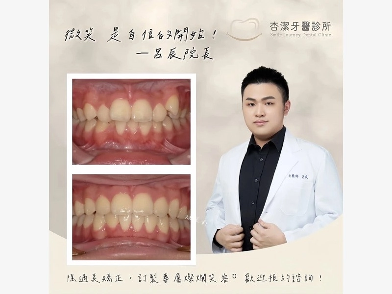新年新希望，從微笑開始(量身定製專屬的微笑矯正計劃)