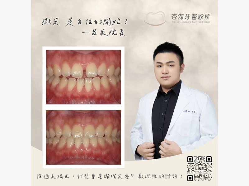 【告別門牙縫！讓財富不再溜走💸】