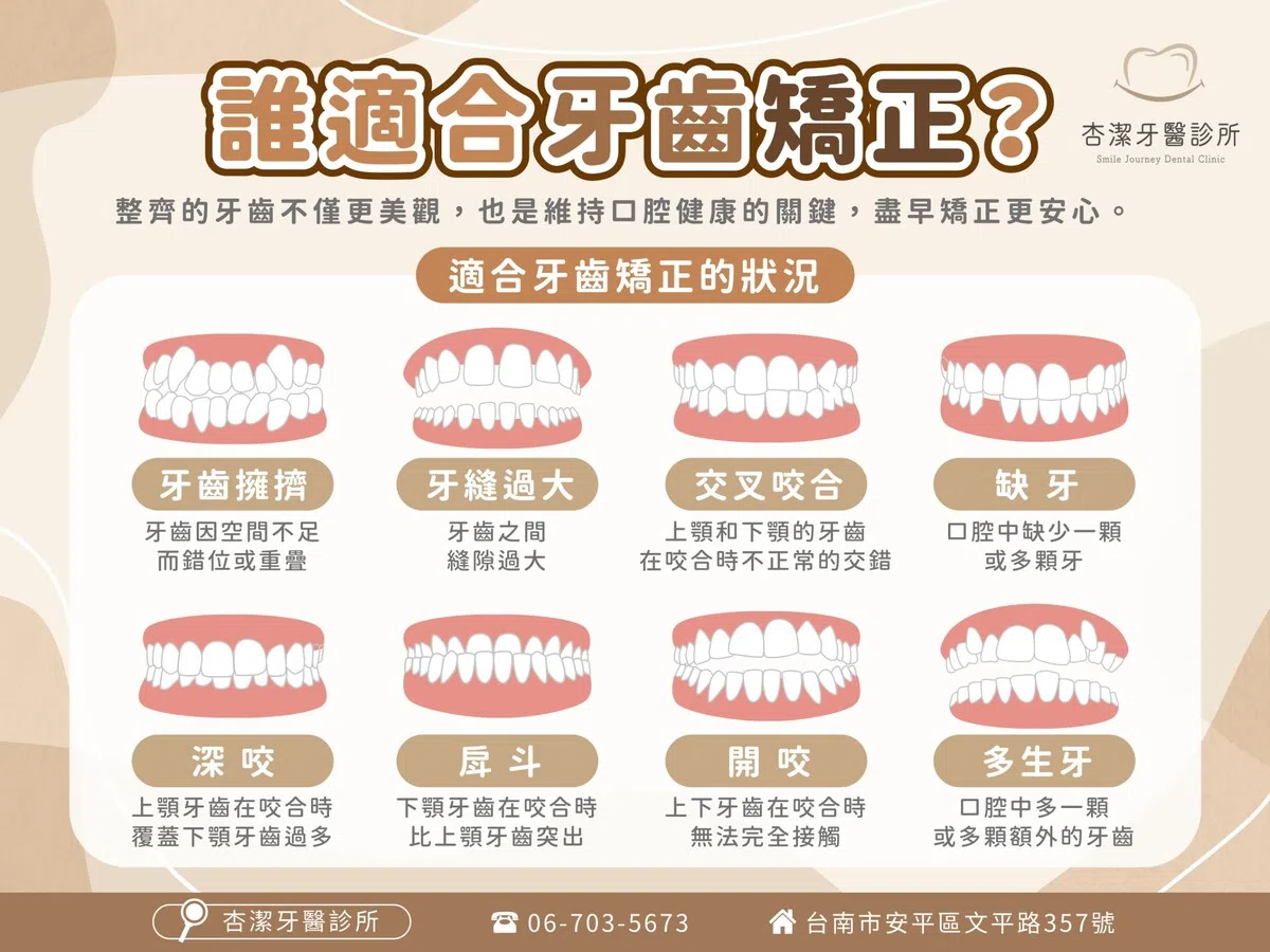 隱適美矯正 隱適美矯正